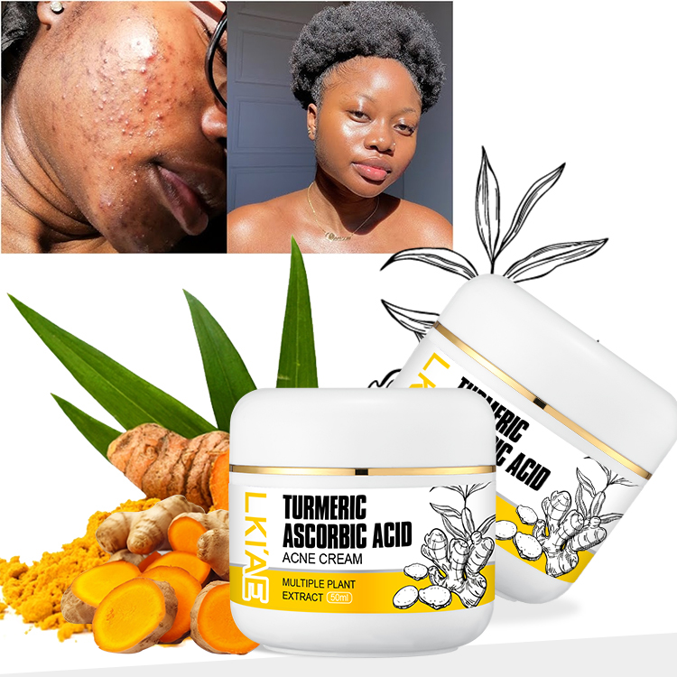 Natural Ingredients With Niacinamide 50ml Curcuma Reduce Dark Spots Lightening Face Cream Lotion Gel for Hyperpigmentation