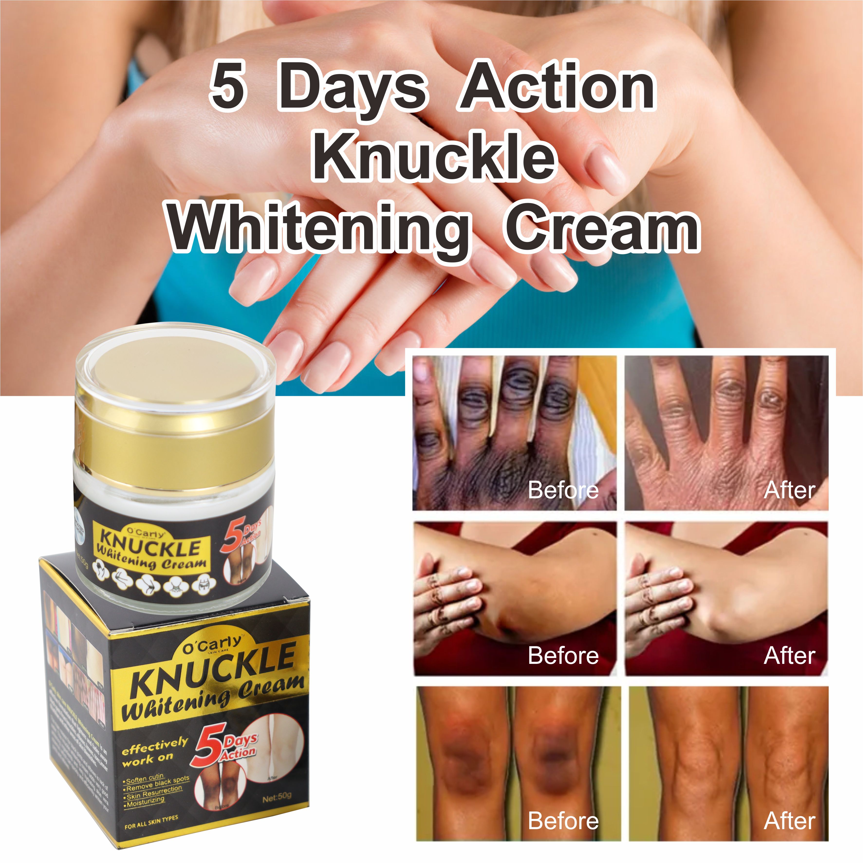 RTS Skincare (New) Private Label Hyaluronic Acid Knees Dark Elbows Lightening Skin Best Whitening Cream Dark Knuckles Removal
