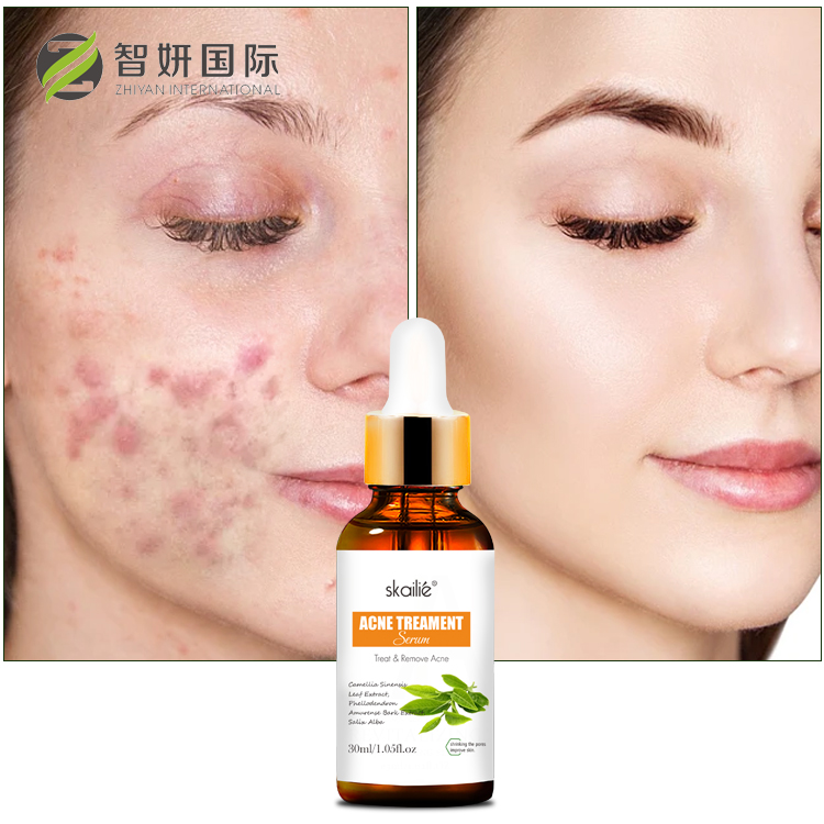 Private Label Skin Care Natural Plant Moisturizing Hydrating Repair Face Tea Tree Acne Serum