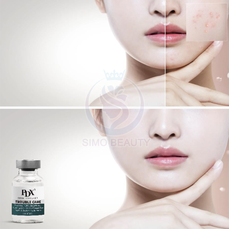 PDRN Solution Anti Inflammation Advanced Peptide Formula Dermatology Inspired Skincare for Weak Skin Barrier
