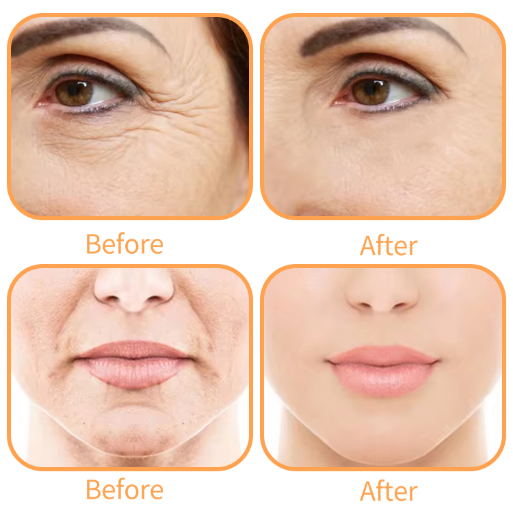 Private Label Anti-Aging Face Cream Natural Skincare Moisturizer with Vitamin a and Retinol Firming Collagen-Based Ingredients