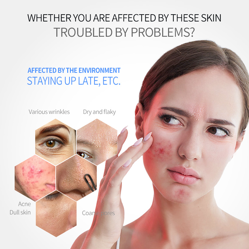 Custom Natural Hydrating Nourishing Facial Skin Care Essence Products Manufacturers Korean All in One Cosmetic Face Serum Oil Wi