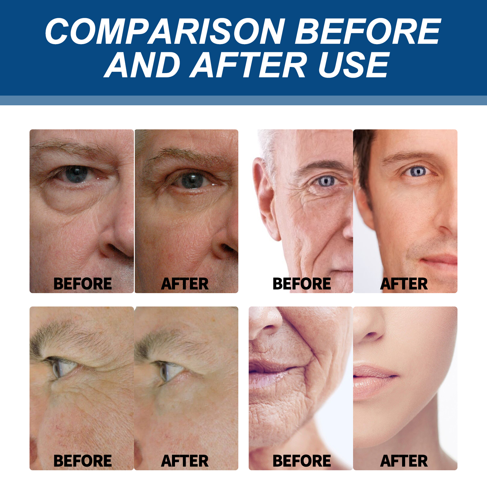 Facial Skincare Wholesale Private Label East Moon Vitamin E Retinol Deeply Moisturizing Skin Face Cream for Men Night Cream