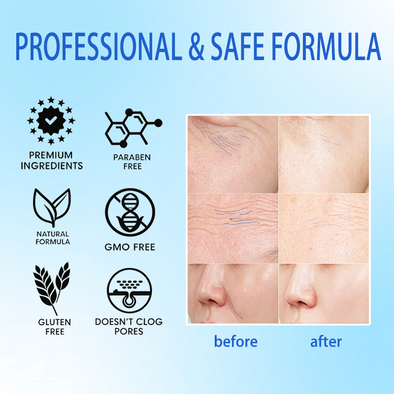 OEM Wholesale Fine Lines Daily Use Men Retinol Collagen Face Care Recovery Deep Hydration Nourishing Rentinol Moisturizer Cream