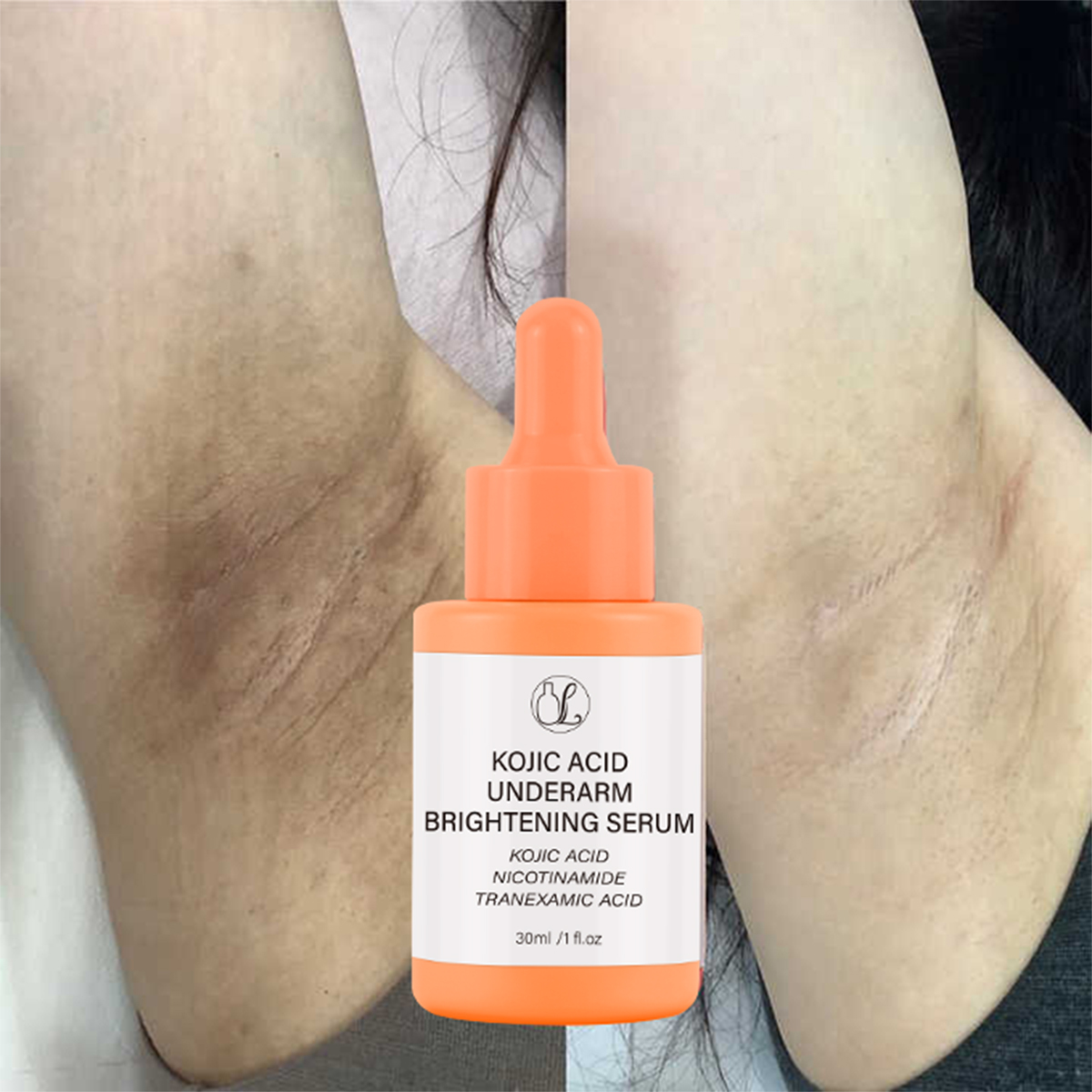 Private Label Kojic Acid Serum Whitening Face &amp; Body with Niacinamide Vitamin C Underarm Skincare Kojic Acid Turmeric Serum
