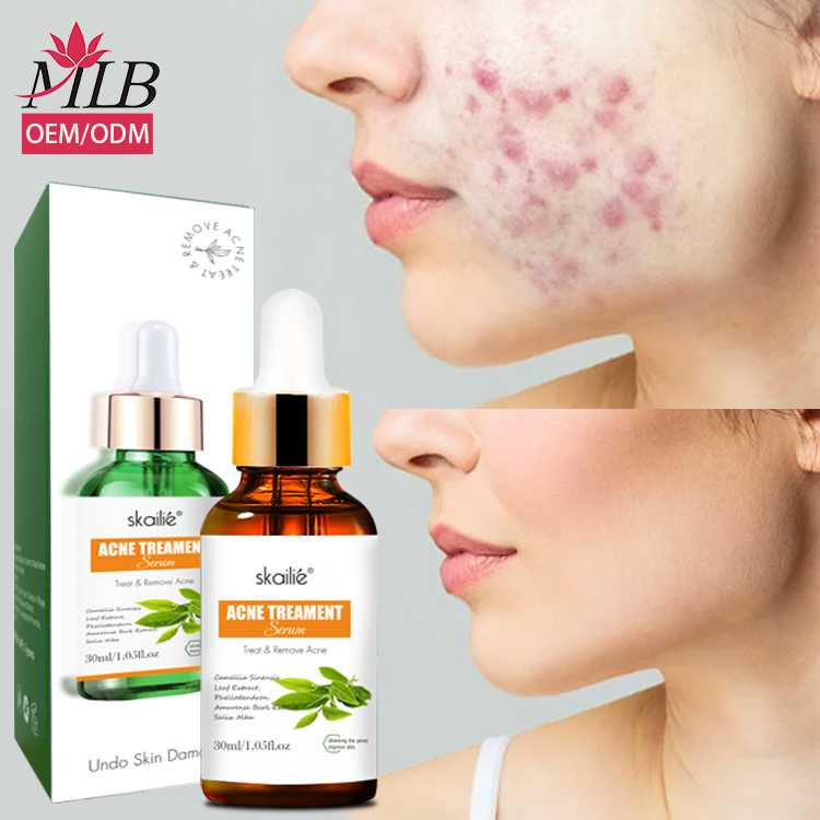 Ready to Ship Private Label Natural Plant Moisturizing Hydrating Repair Face Tea Tree Acne Serum