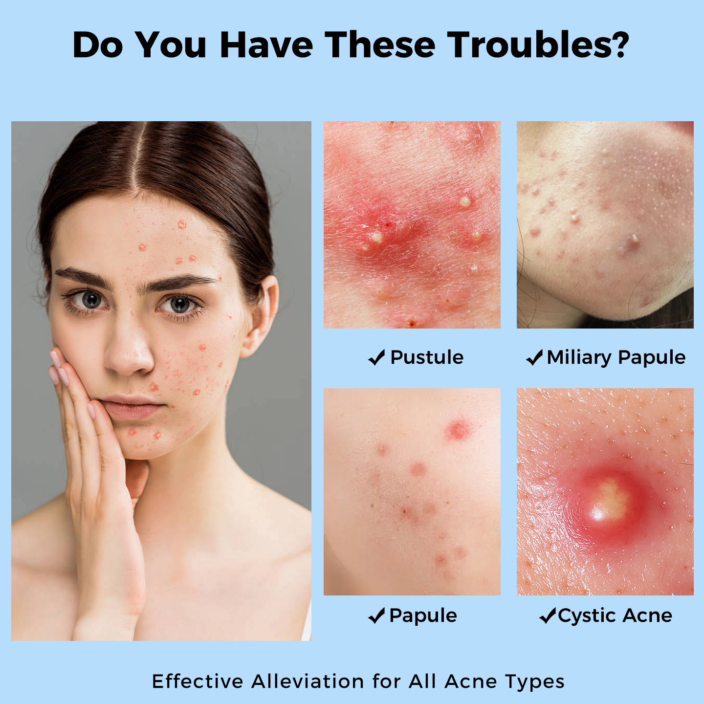 Skin Care Microneedle Pimple Patches Rapid Ingredient Penetration Acne Patch
