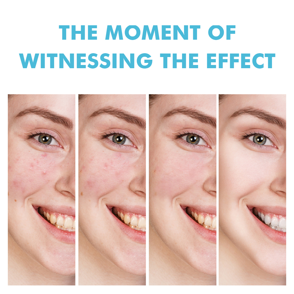 Hot Sale Effective Salicylic Acid Salvia Miltiorrhiza Acne Removal Gel Unclog Pores Deeply Cleaning 20g MOOYAM Acne Removal Gel