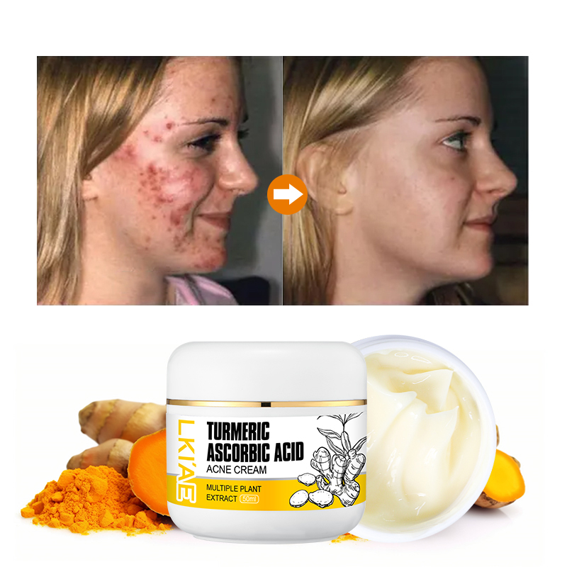 Natural Ingredients With Niacinamide 50ml Curcuma Reduce Dark Spots Lightening Face Cream Lotion Gel for Hyperpigmentation