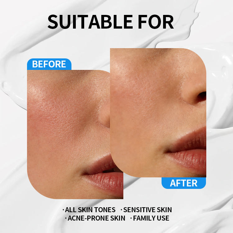 Factory ODM/OEM Skincare Product Moisturizing Hyaluronic Acid Oil-control Refresh Cleanser Serum Cream Korean Skin Care Set
