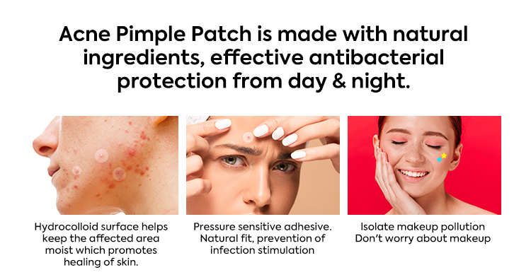 Acne Patch Feature 1