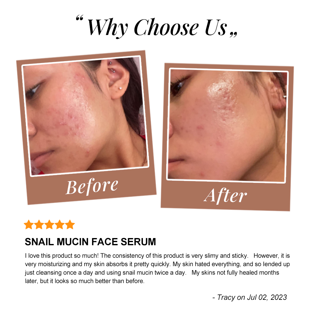 Korean Cosmetics Beauty Skin Care Products Snail Mucin Collagen Face Serum Anti Aging Wrinkles Facial Mask Cream Skincare Set