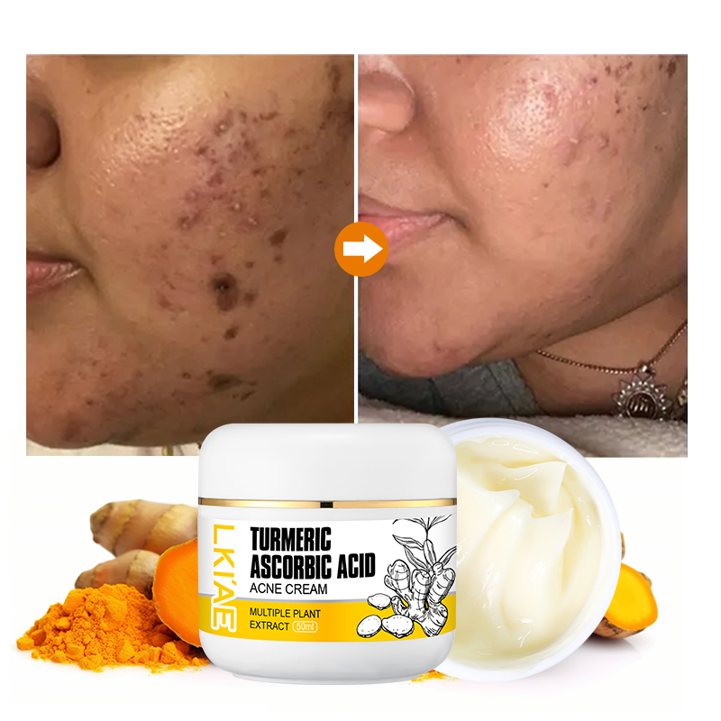 Natural Ingredients With Niacinamide 50ml Curcuma Reduce Dark Spots Lightening Face Cream Lotion Gel for Hyperpigmentation