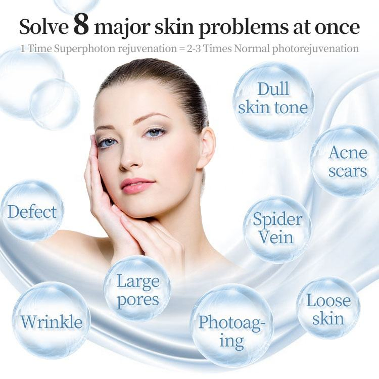Black Gold Dpl Ultra-Photon Skin Rejuvenation Device