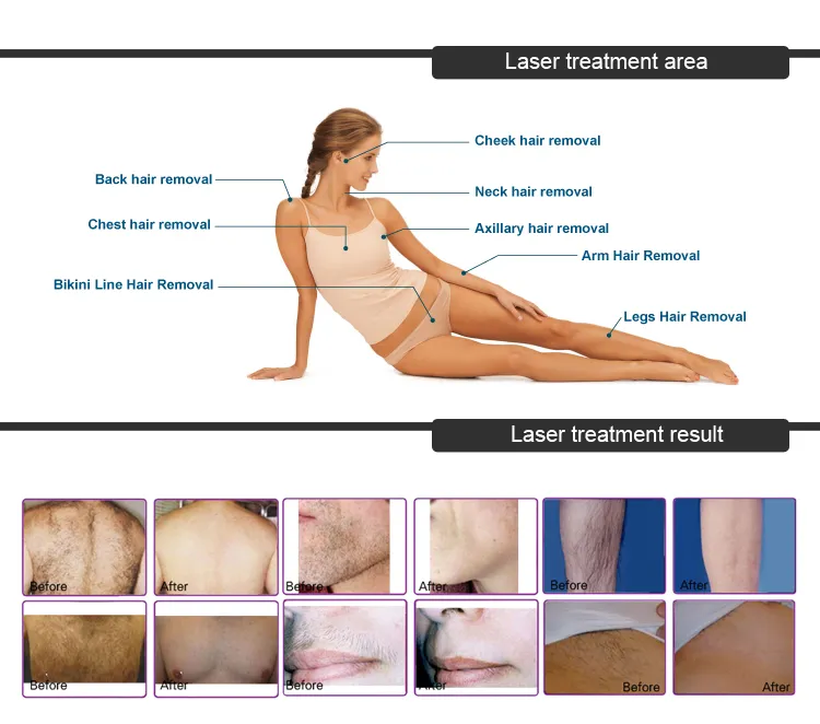 Before and After Treatment Areas