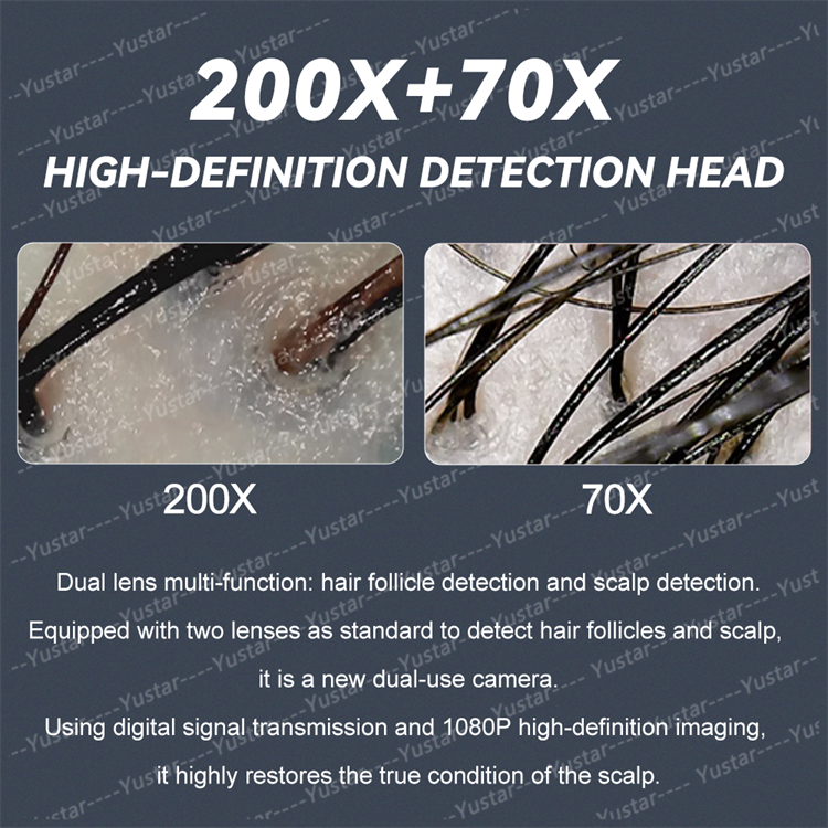 Scalp Care Integrated Device Feature 1