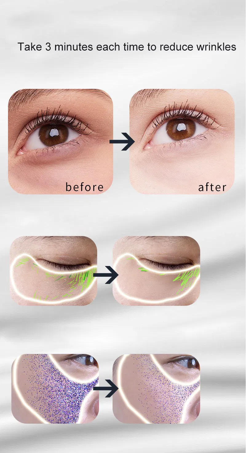 Pakiss OEM/ODM Support 7 Color LED + EMS Microcurrent Eye Beauty Device, Reduce Dark Circles Eye Bags Wrinkles