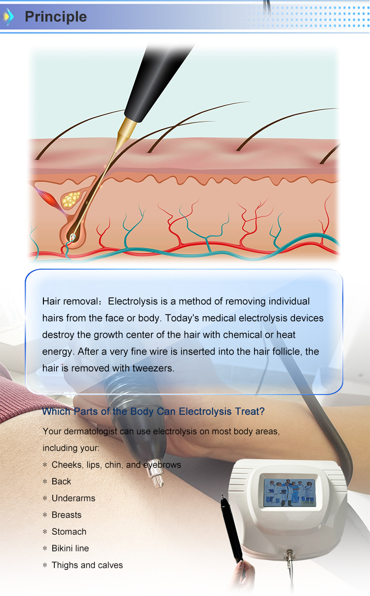 Treatment Image 1