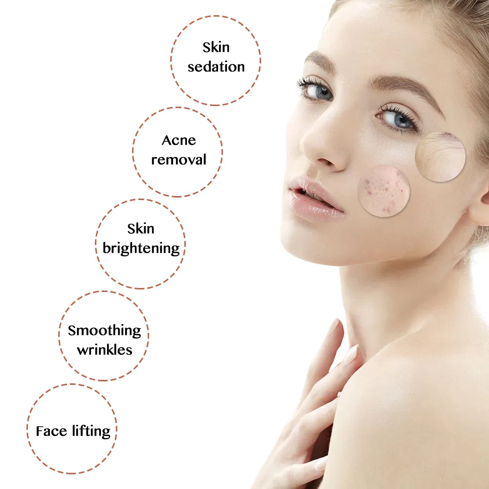 Beauty Personal Care Health Medical 5 in 1 EMS RF LED Mesotherapy Portable Facial Wrinkle Remover Ultrasonic Beauty Device