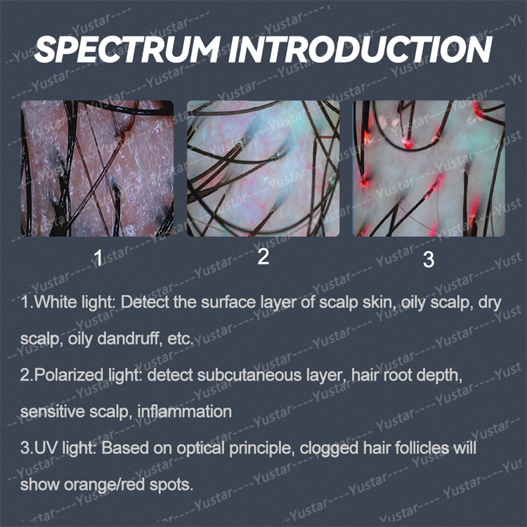 Scalp Care Integrated Device Feature 2