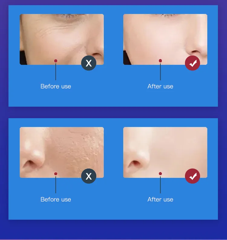 PDT Device Detail