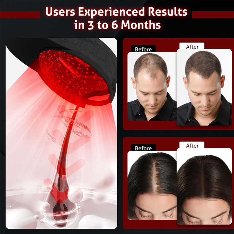 Wholesale Price Red Light Therapy Sports Cap 660nm 850nm Infrared Led Lamp Home Use Beauty Equipment One Year