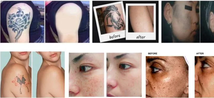 Before & After Results Comparison