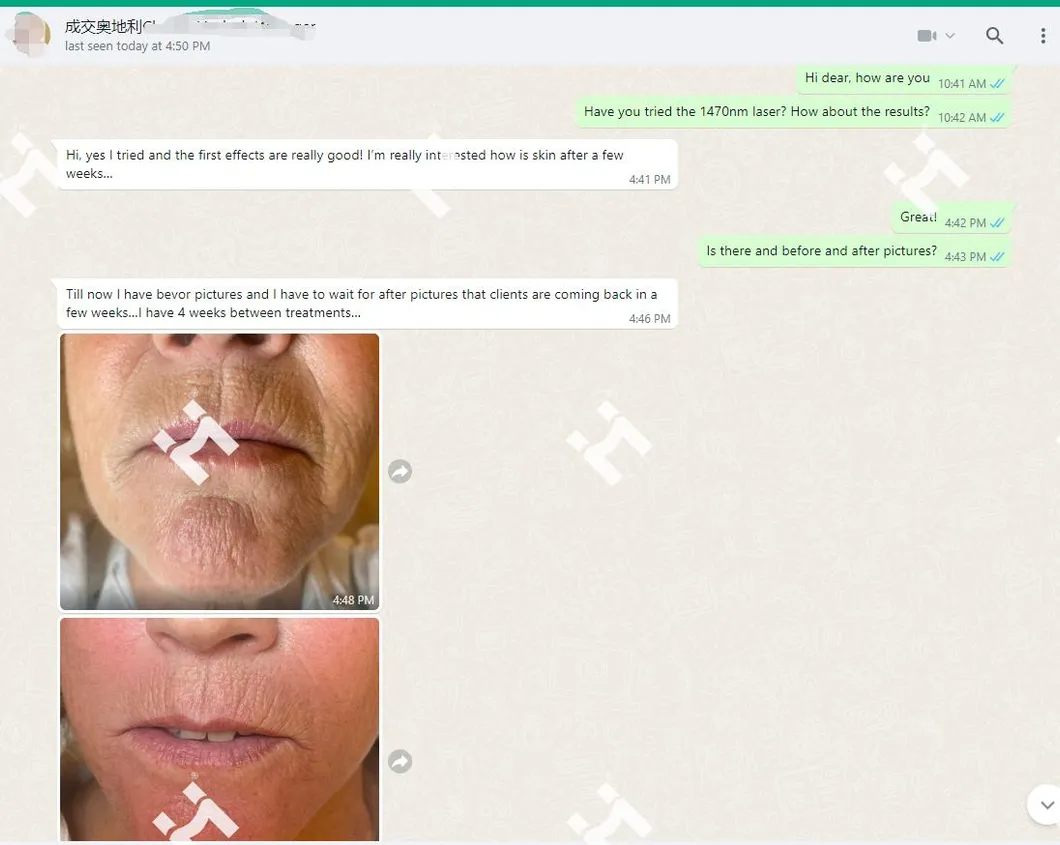 Customer Feedback 1