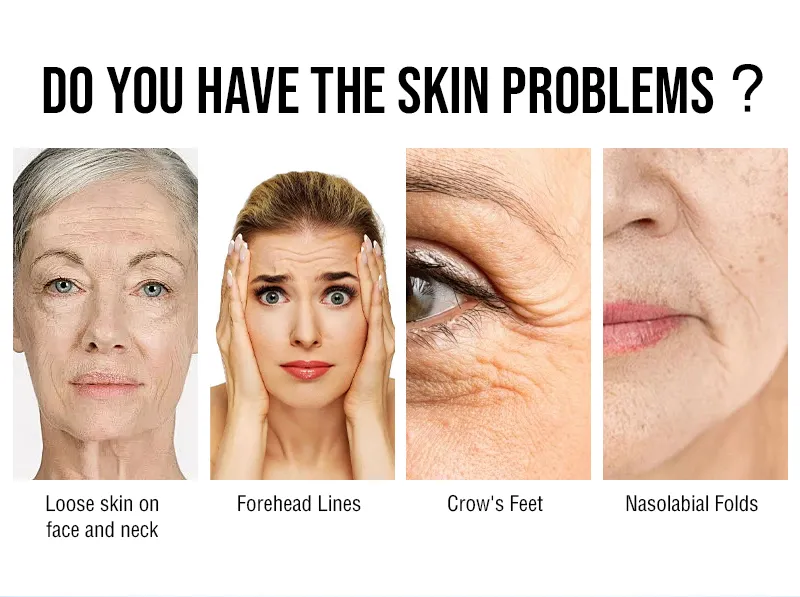 Laser Wrinkle Removal Face Lift Device