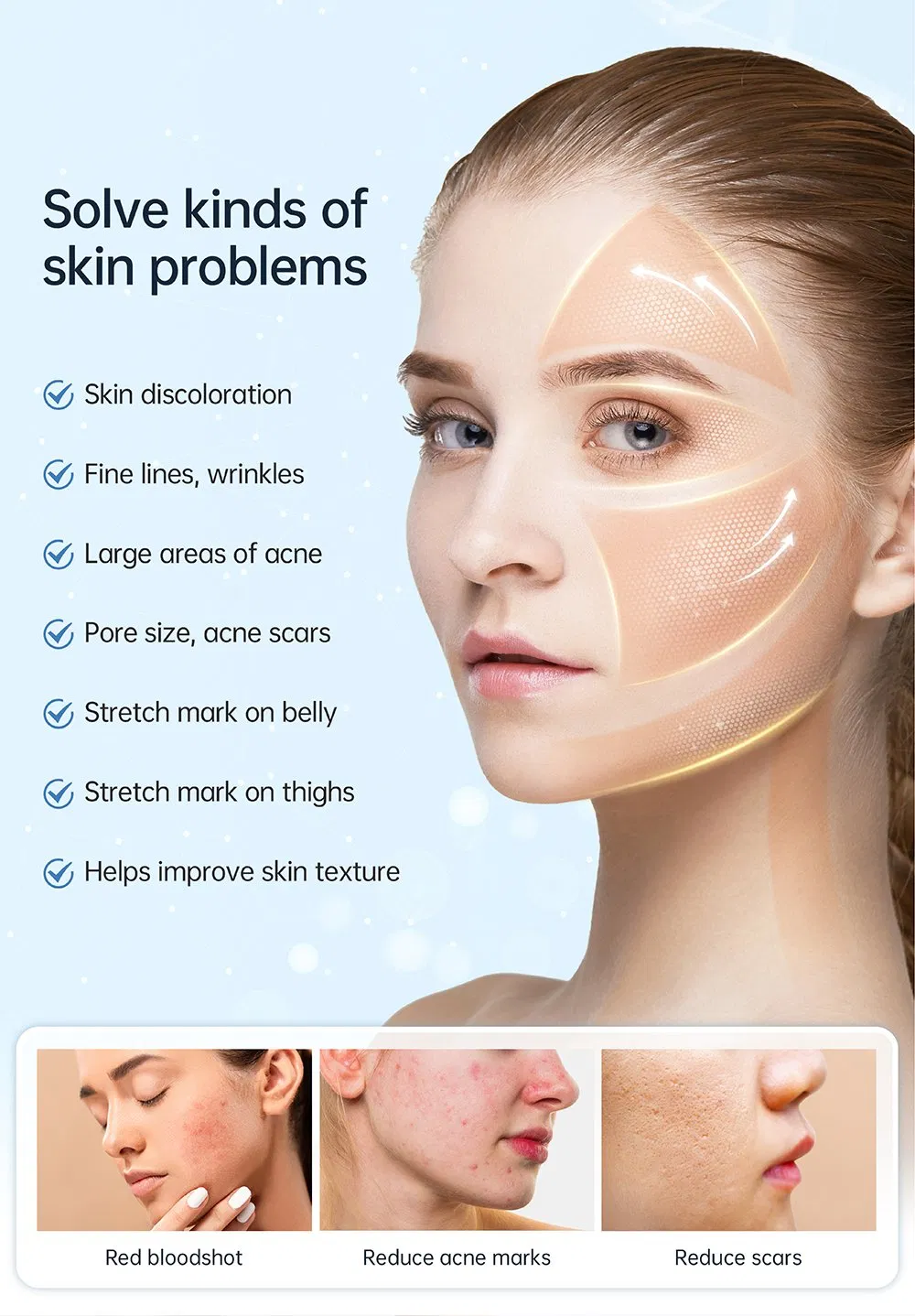 Advanced Skin Tightening Microneedle Beauty Device for Home Use