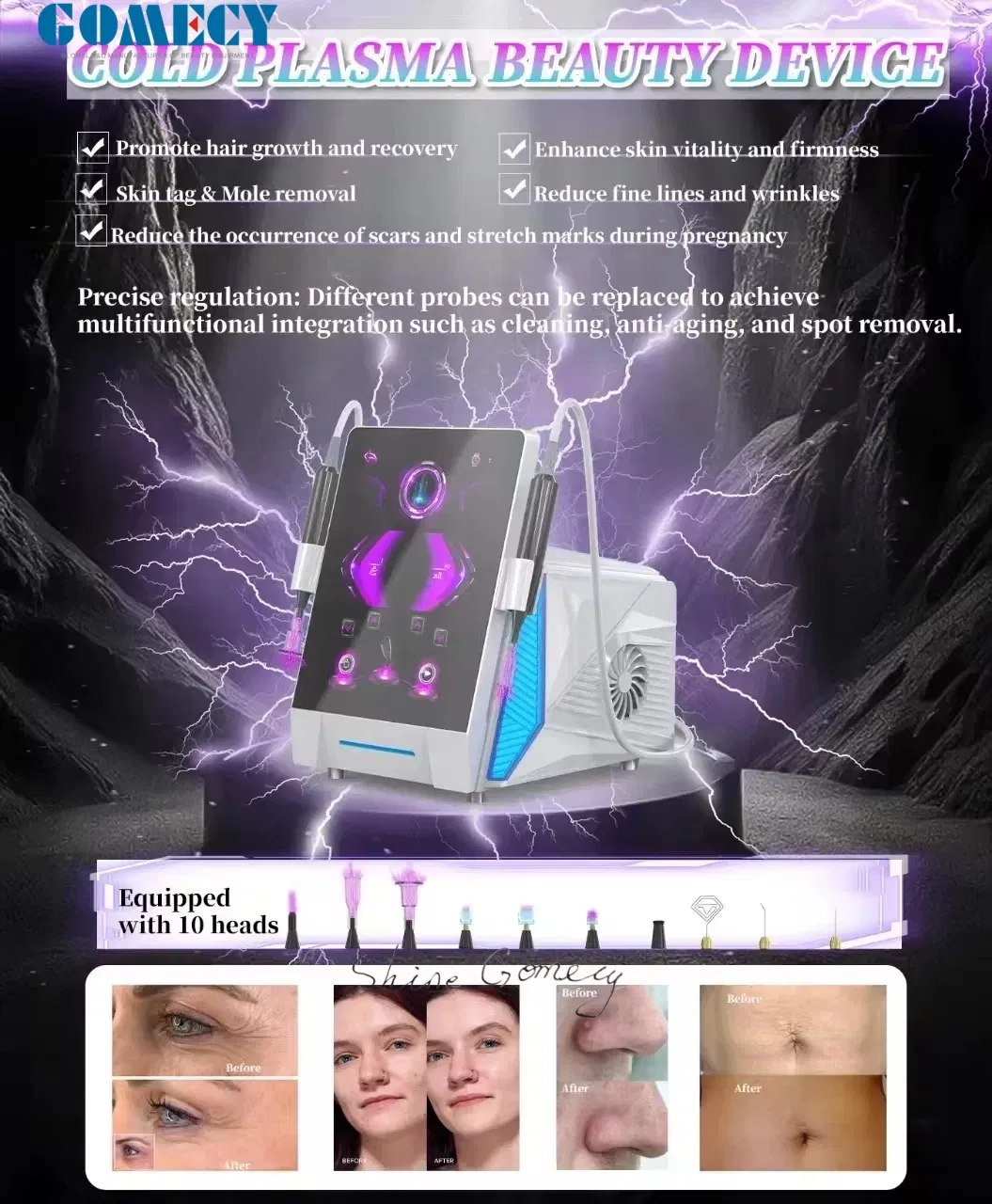 New Arrivals Newest Innovative Beauty Products Plusma World's 1 Cold Fractional Technology Anti-Aging Device