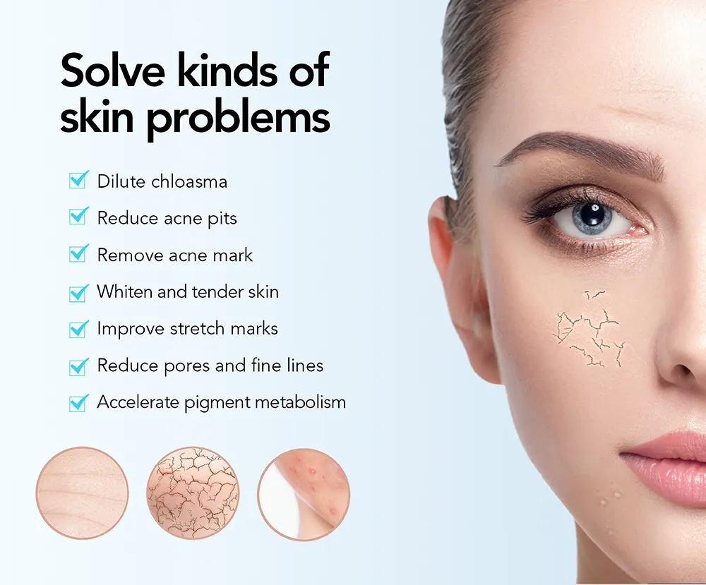 Professional Microneedling Device for Skin Renewal and Rejuvenation