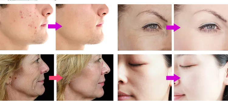 Before and After Results