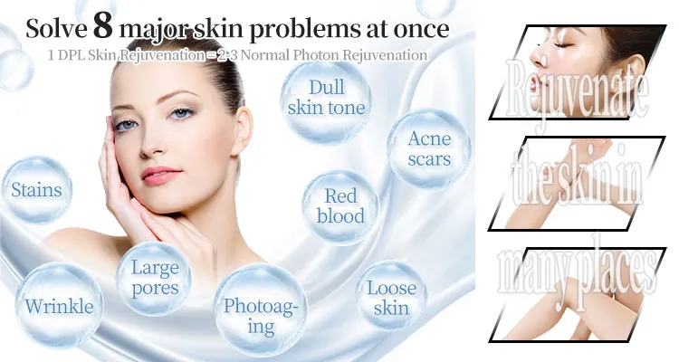 Black Gold Dpl Ultra-Photon Skin Rejuvenation Device Layout 4