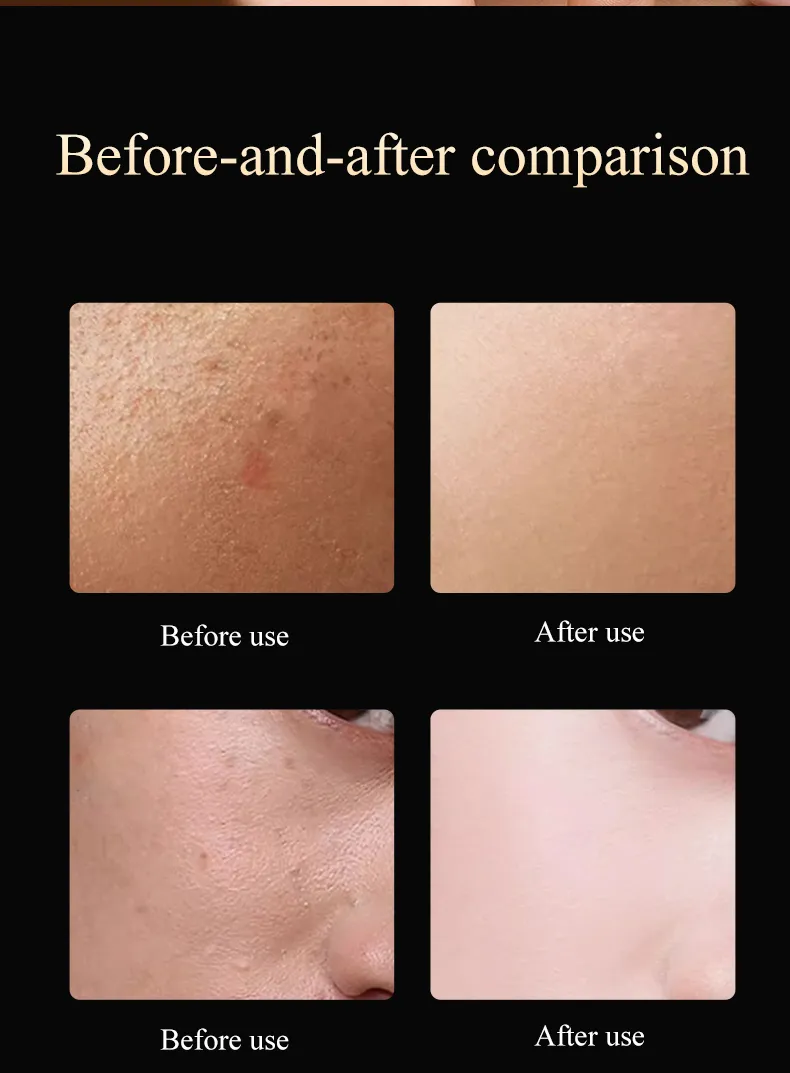 Beauty Device Anti-Aging Features