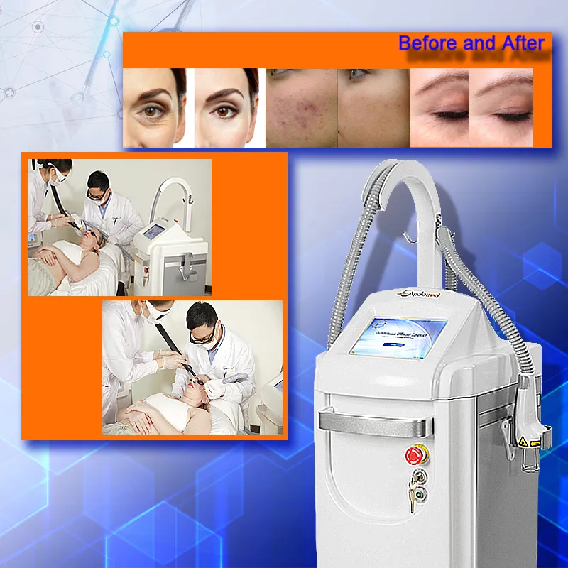 Laser Resurfacing Before and After Comparison