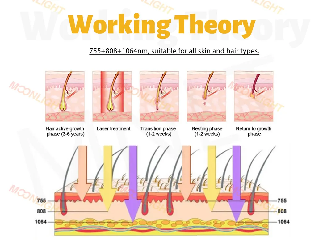 Portable Diode Laser Hair Removal Device for Beauty Salon