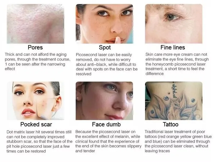 Tattoo Removal Applications