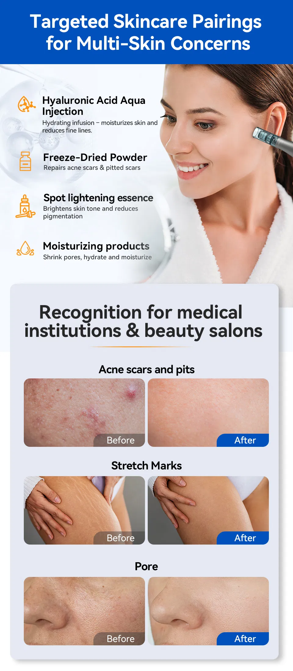 Advanced Micro Needle Anti-Aging Beauty Device for Professionals