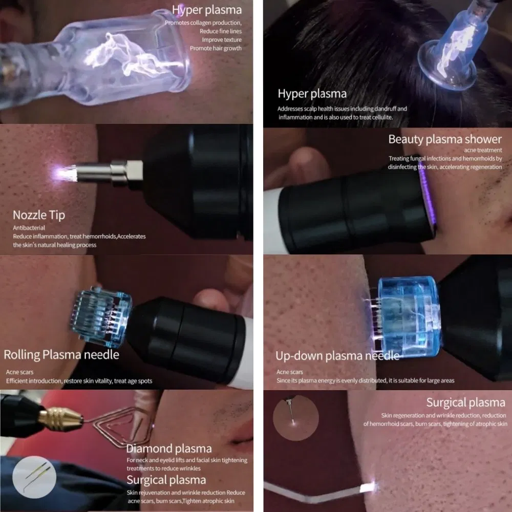 Ofan Portable Acne Scars Removal Cold Plasma Treatment Facial Lifting Cold Jet Plasma Cold Plasma Beauty Device
