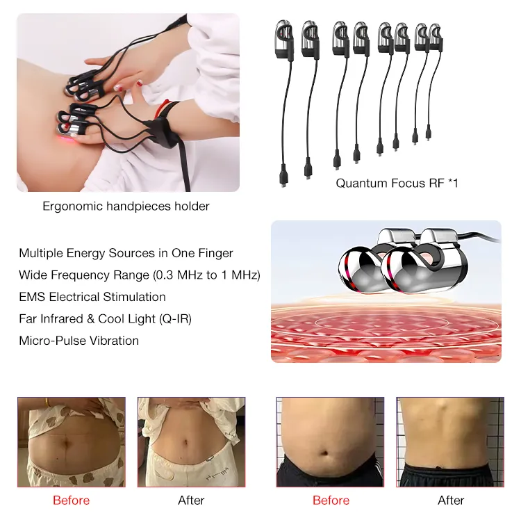 Advanced RF Skin Tightening Device Operation Panel