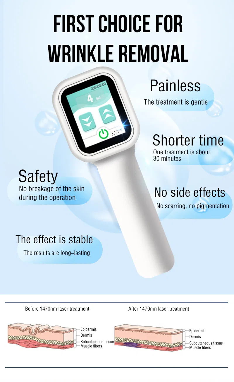 Laser Wrinkle Removal Face Lift Device