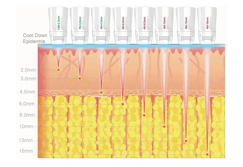 Portable Hifu Device for Skin Tightening & Body Contouring Treatments