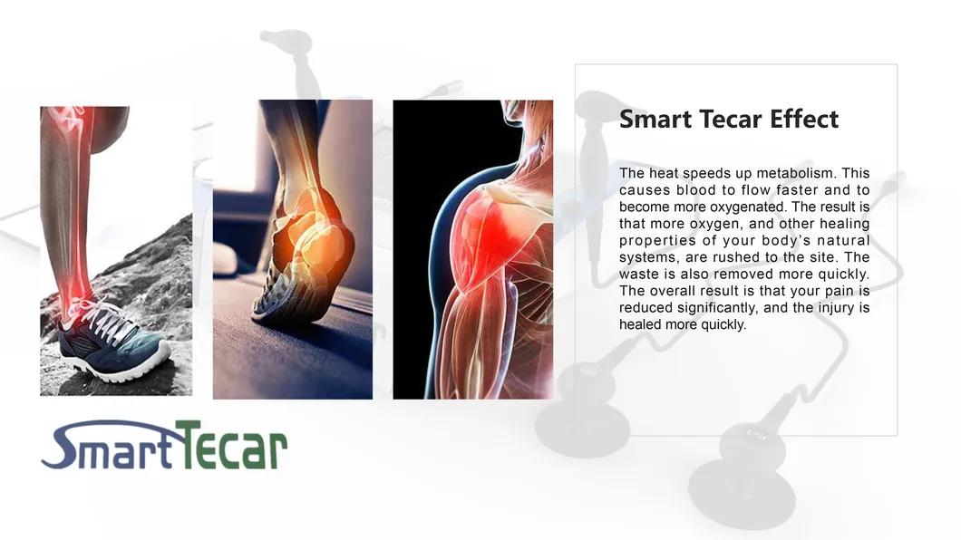 Professional Magic Tecar Therapy Detail 4