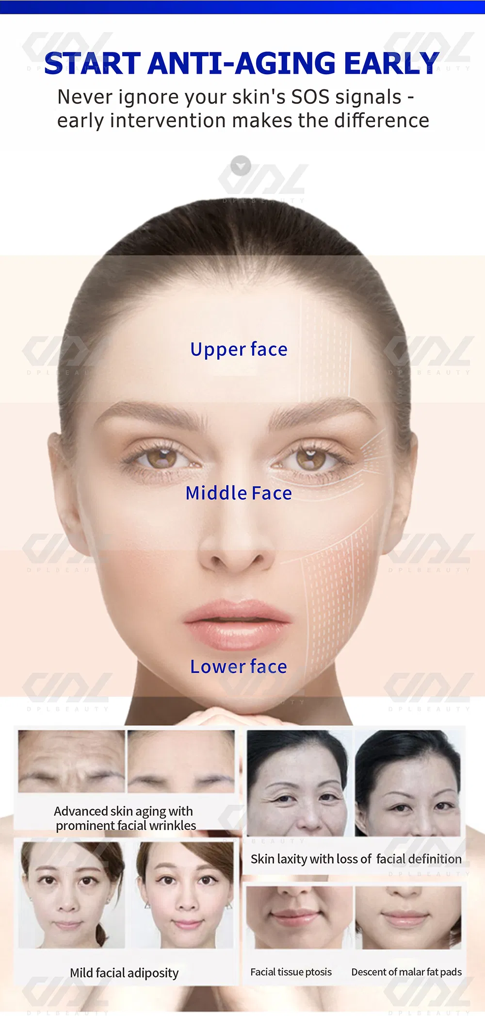 HiFi 2.0 Skin Rejuvenation Wrinkle Removal Face Lift 2400 Shoots Cartridge Anti-Aging Hefu Beauty Device