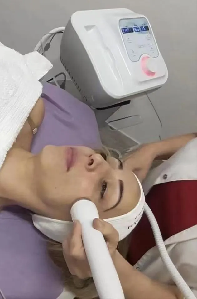 Cryo Facial Machine Image 5