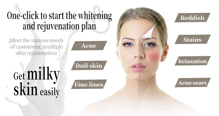 Black Gold Dpl Ultra-Photon Skin Rejuvenation Device Layout 3