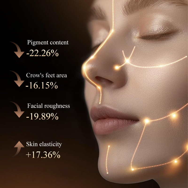 Pakiss Dual-Band Skin Rejuvenation Technology Black Gold Photon Beauty Device for Anti-Aging &amp; Firming