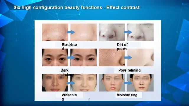 2021 Latest Smart Ice Blue Aqua Hydro Facial Skin Cleansing Jet Peel Beauty Device Features