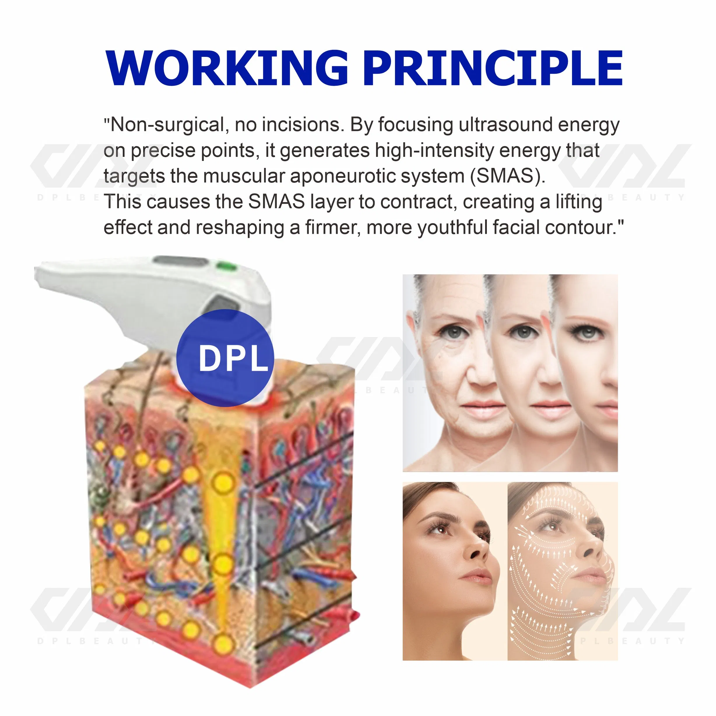 HiFi 2.0 Skin Rejuvenation Wrinkle Removal Face Lift 2400 Shoots Cartridge Anti-Aging Hefu Beauty Device